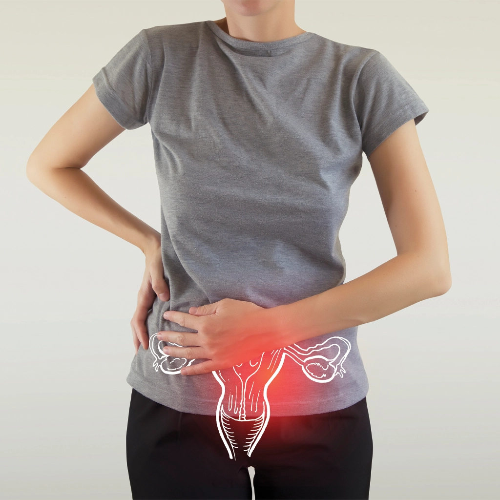 Differences Between UFE and Hysterectomy