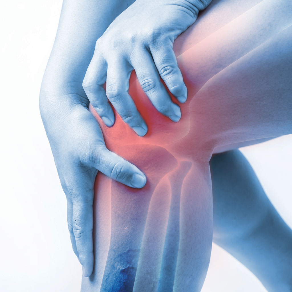GAE vs Total Knee Replacement Illustration