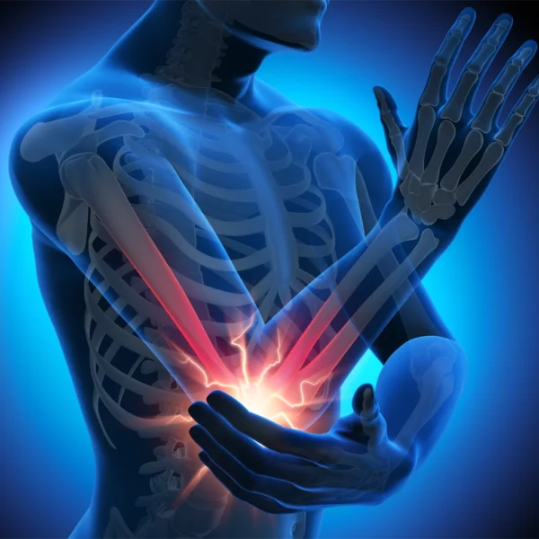Tennis Elbow
